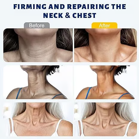 QIAWI™ 5-Roller Neck Firming Cream – Collagen & Hyaluronic Acid for Smoother, Tighter-Looking Neck Skin