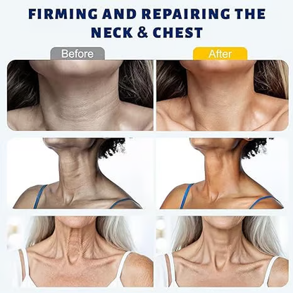 QIAWI™ 5-Roller Neck Firming Cream – Collagen & Hyaluronic Acid for Smoother, Tighter-Looking Neck Skin
