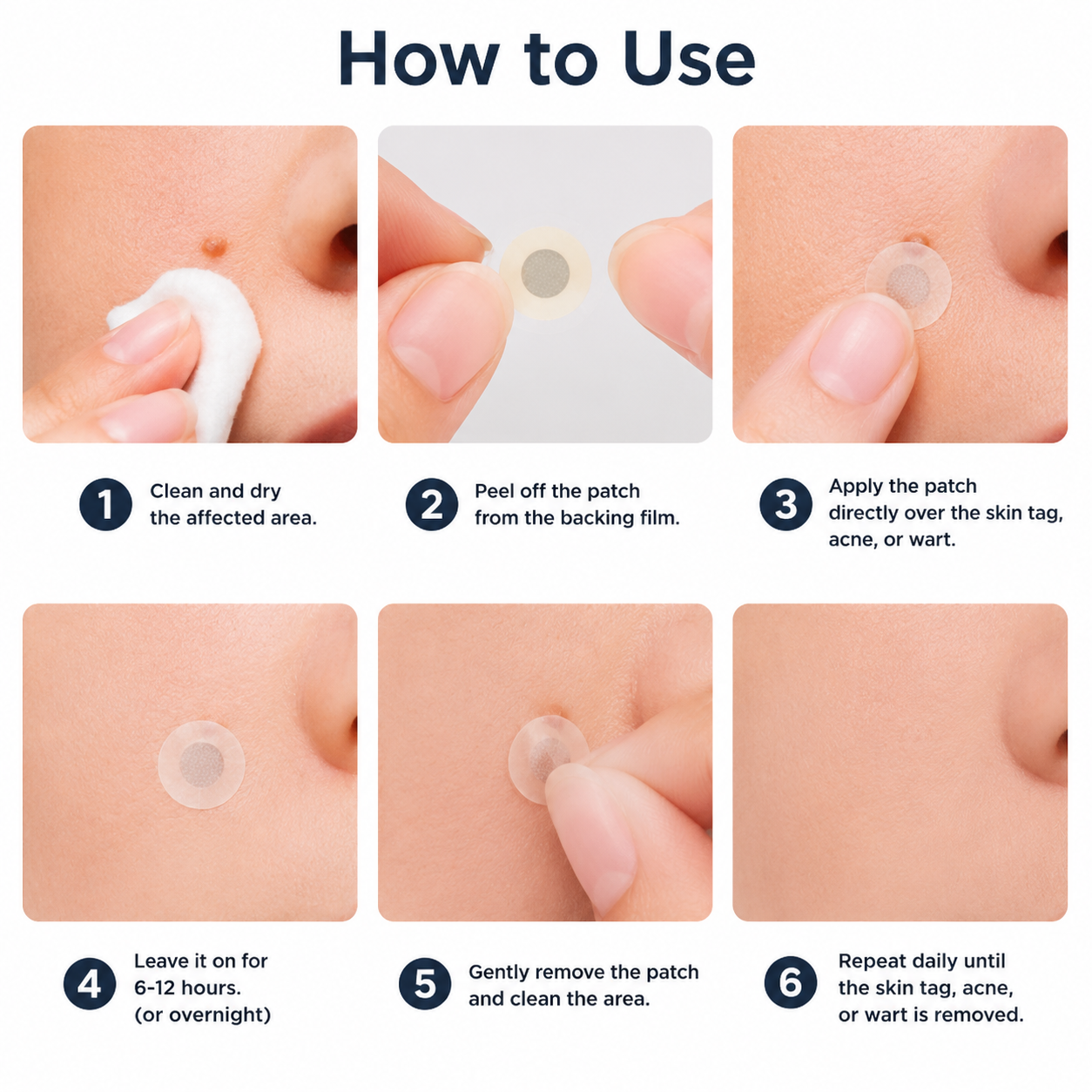 ✨Biancat® 2-in-1 Microneedle & Hydrocolloid Patch🍀| Removes Raised Moles, Acne, Flat Warts & Skin Tags | Helps Improve Wrinkles, Scars & Blemishes | Invisible Patches for Face & Body