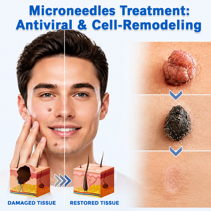 ✨Biancat® 2-in-1 Microneedle & Hydrocolloid Patch🍀| Removes Raised Moles, Acne, Flat Warts & Skin Tags | Helps Improve Wrinkles, Scars & Blemishes | Invisible Patches for Face & Body