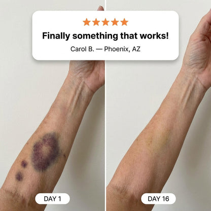 💥100K+ SOLD💕- QIAWI™ Bruise Repair & Skin-Strengthening Cream